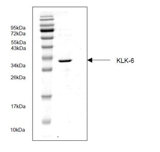 Kallikrein 6 (KLK-6)