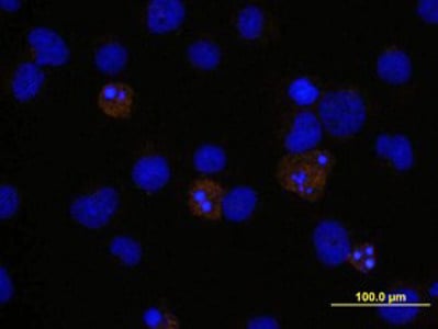 その他 allbindsM8.5 Human/Mouse Cleaved Caspase-3 (Asp175) Antibody MAB835 from
