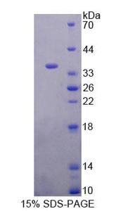 Mouse Complement Component 8a (C8a) Protein