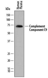 Human Complement Component C9 Antibody
