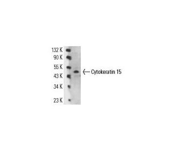 最も優遇 Cytokeratin 15 (LHK15) FITC Antibody sc-47697 FITC from その他