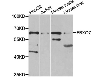 FBXO7 Antibody
