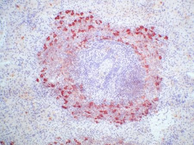 Follicular Dendritic Cells antibody