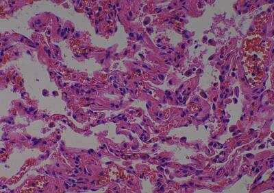 Human Lung Tissue MicroArray (Normal)