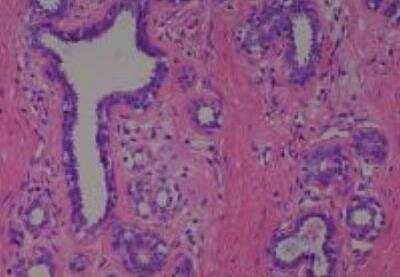 Human Multi Tissue MicroArray (Normal Adjacent)