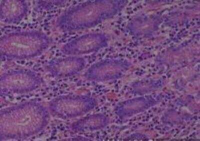 Human Multi Tissue MicroArray (Normal Adjacent)