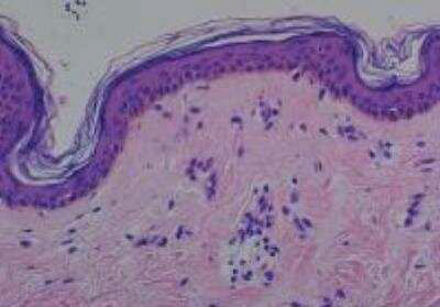 Human Multi-tissue Tissue MicroArray (Normal)