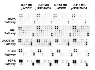 Human Phosphorylation Pathway Profiling Array C55
