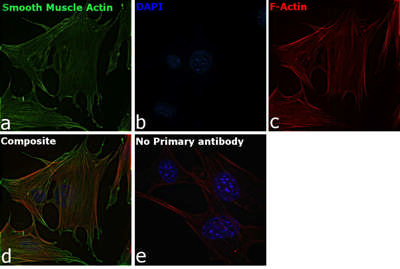 ma5ページ Alpha-Smooth Muscle Actin Antibody MA5-11547 from Thermo