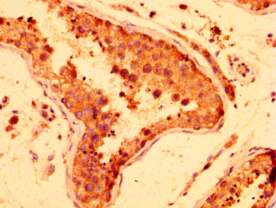 LRRFIP2 Antibody