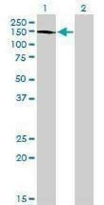 Anti-ABL2 Antibody