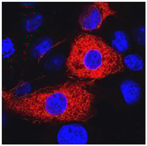Dapi様 Importance of Selenoprotein O in Regulating Hmgb1: A New