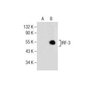 ゆ③ Amazon.com : HD Switch Ball Joint Rod End Deck Linkage 5/8