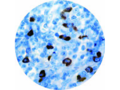 Macrophage HAM-56