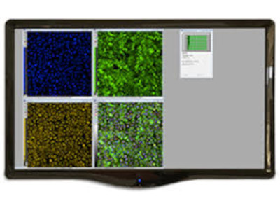 MetaXpress High-Content Image Acquisition and Analysis Software from Molecular Devices LLC