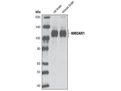 NMDA Receptor 1 (GluN1) (D65B7) Rabbit mAb