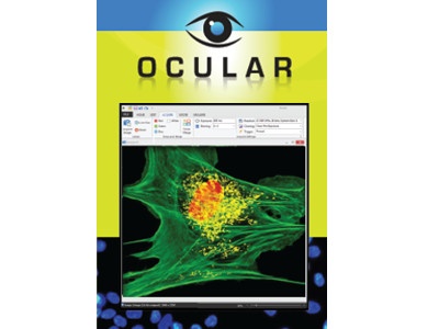 Ocular Image Acquisition Software from QImaging