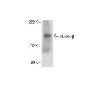 ゾロアーク 035/047 psa10 PSA10鑑定済〕ヒスイゾロアークVSTAR【SAR】{234/172}