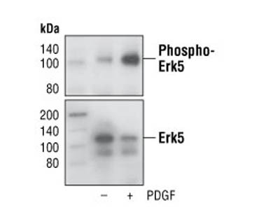 Phospho-Erk5 (Thr218/Tyr220) Antibody