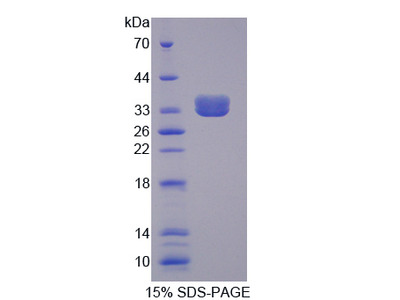 Recombinant Complement Component 3 (C3)