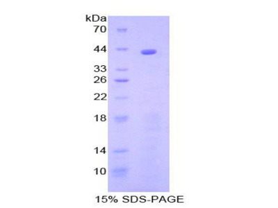 Recombinant Complement Component 8b (C8b)