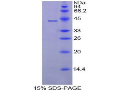 Recombinant Complement Component 8b (C8b)
