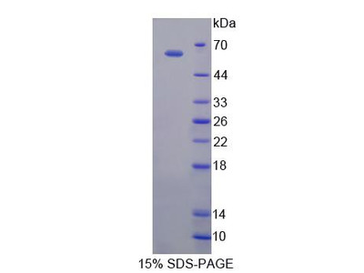 Recombinant Eomesodermin (EOMES)