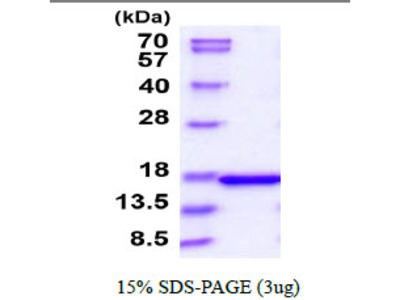 Recombinant FGF Basic