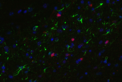 S100B Antibody 287 003 from Synaptic Systems GmbH