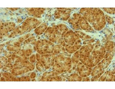 Mouse Anti-Transportin 1/MIP Antibody