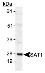 Rabbit Anti-SSAT-1 Antibody