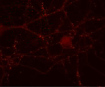 だいページ VGLUT2 antibody 135 403 from Synaptic Systems GmbH