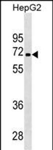 PDK3 Antibody